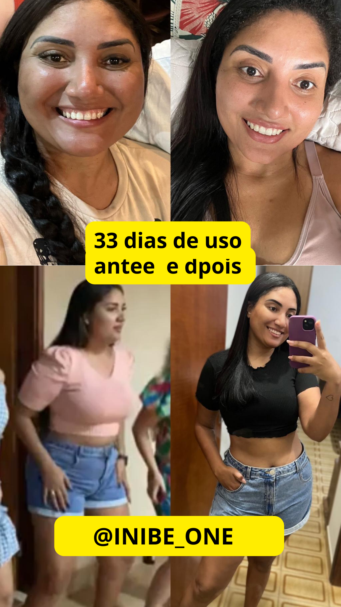 Resultado Inibe One — antes e depois 33 dias de uso