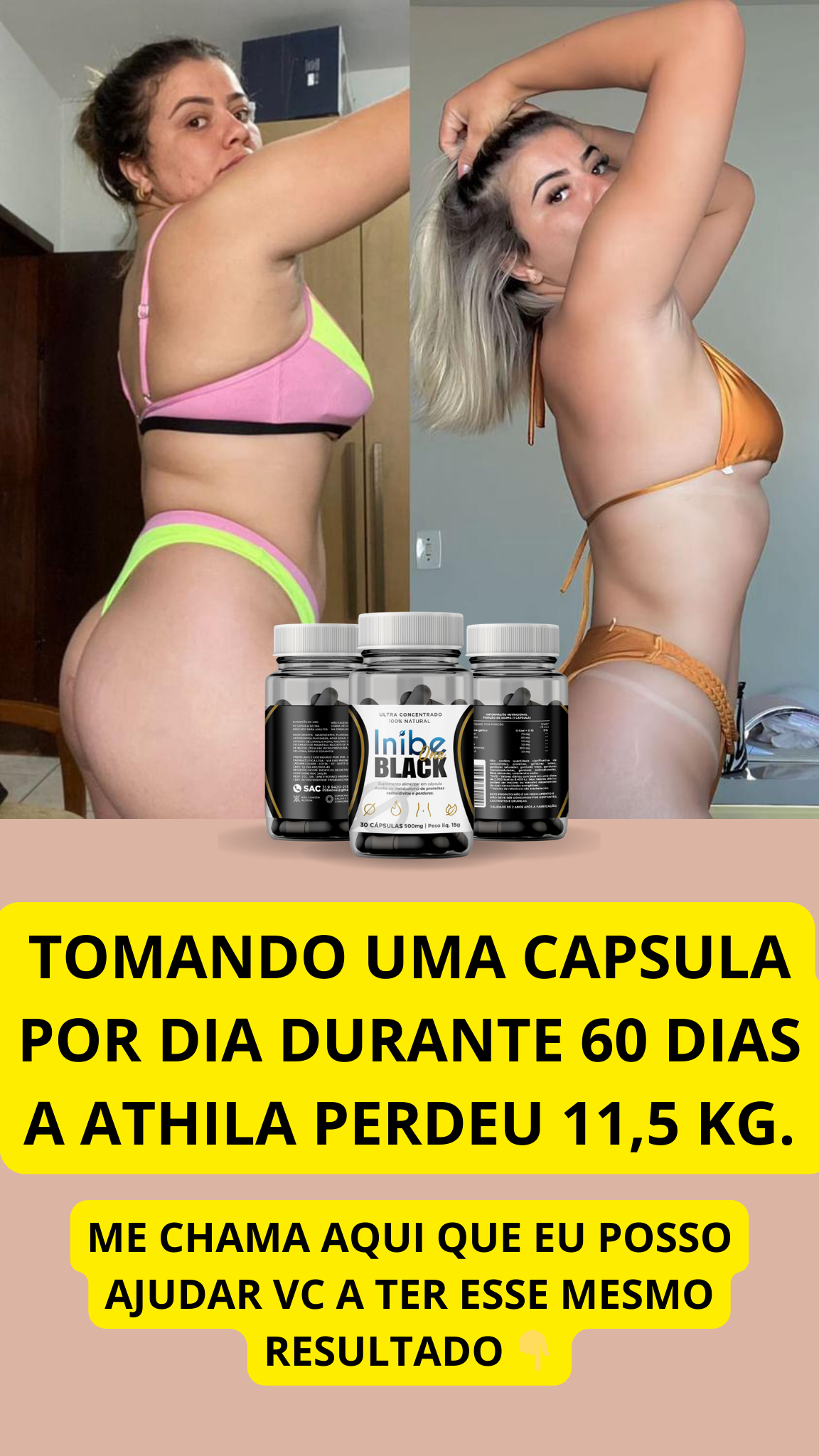 Inibe One antes e depois — Athila perdeu 11,5 kg em 60 dias